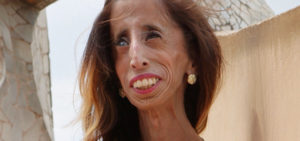 ‘World’s Ugliest Woman’ fights bullying with forgiveness